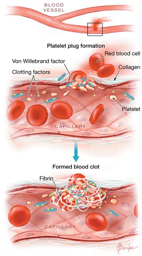 Coagulopathy: Causes, Symptoms & Treatments | Global Treatment Services Pvt. Ltd.