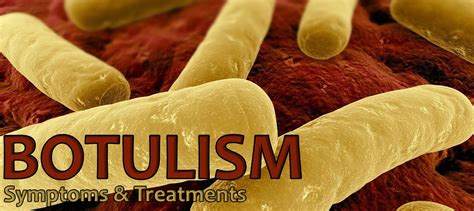 Botulism - Causes, Symptoms, Infant Botulism, Prevention & Treatment