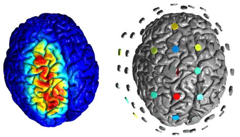 Neurophysics - Magnetic Resonance