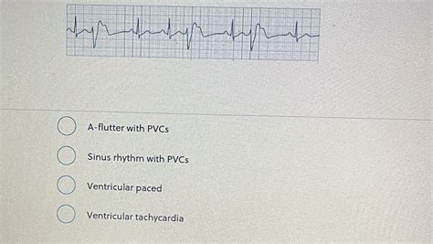 Solved A-flutter with PVCs Sinus rhythm with PVCs | Chegg.com