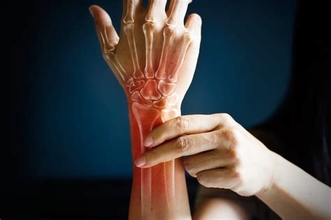 What's Causing My Wrist Pain? - Spine Center of Texas