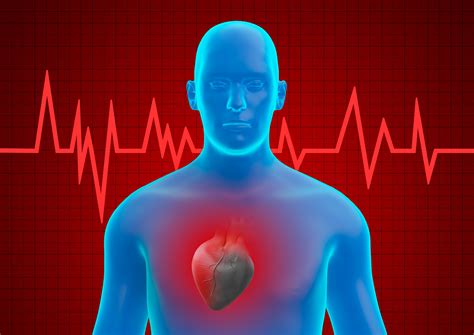 General Approach to Acute Myocardial Infarction with Nonobstructive ...