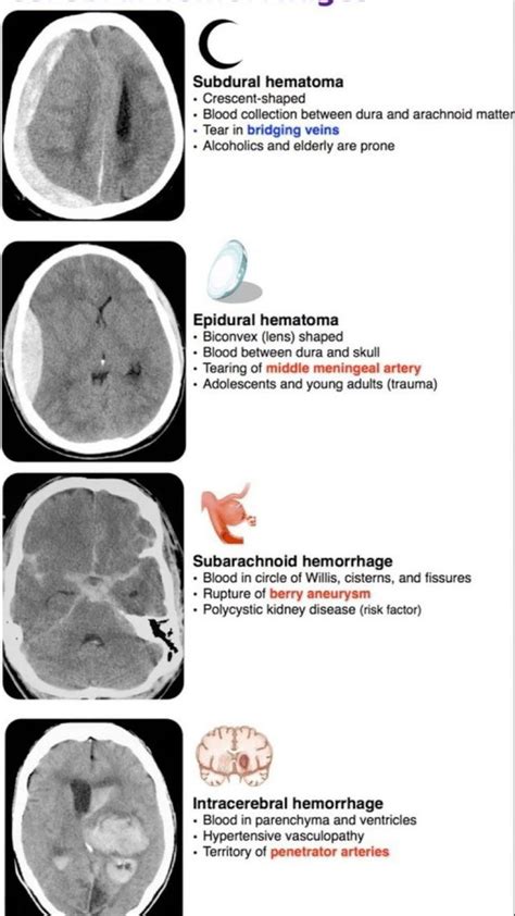 Pin by KEMIKA on Brain 🧠 in 2023 | Medical anatomy, Medical school ...