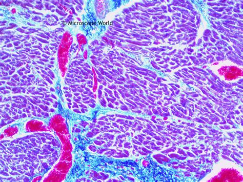 Microscope World Blog: Human Cardiac Muscle under the Microscope