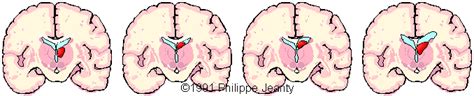 Germinal Matrix Brain Anatomy