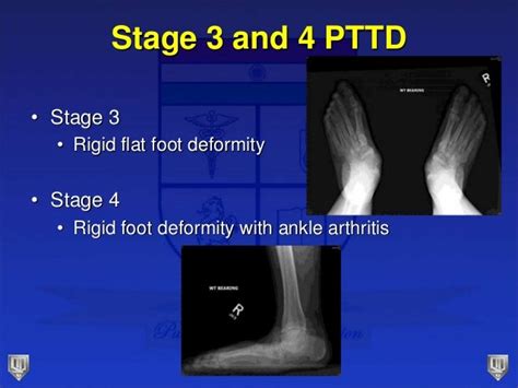 Lecture 27 parekh pttd3 and 4