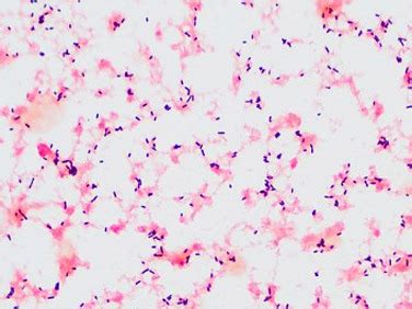 Listeria Monocytogenes Gram Stain Images - img-Aaralyn