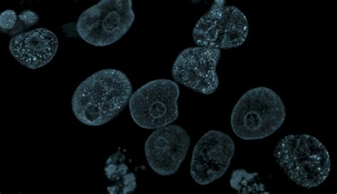 Single Cell Sequencing: Techniques, Technologies, & Analytical Methods