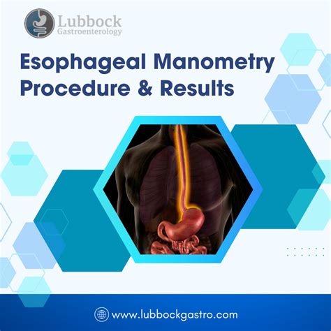 Esophageal Manometry Lubbock, TX | Procedure & Results