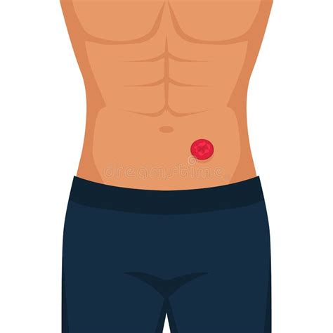 Man with Stoma after Colon Cancer Surgery Stock Vector - Illustration of health, background ...