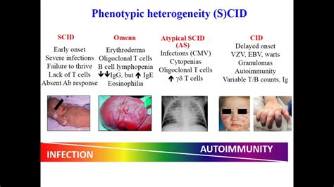 Managing Autoimmune Issues with SCID - YouTube