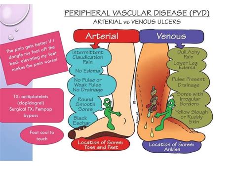 PAD VS PVD | Nursing school studying, Nursing school survival, Nursing tips