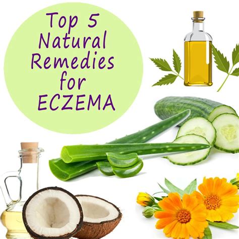 Top 5 Natural Remedies for Eczema (With images) | Natural eczema remedies, Natural skin care ...