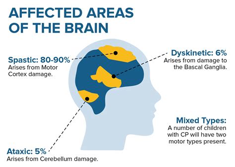 All About Cerebral Palsy | United Cerebral Palsy – Hawaiʻi