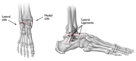 Anatomy of an ankle sprain (2022)