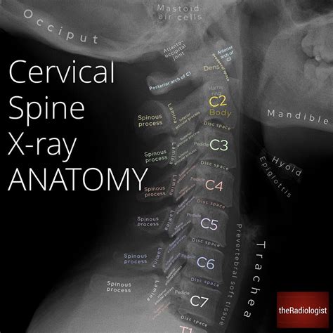 Cervical spine x ray anatomy by dr naveen sharma – Artofit