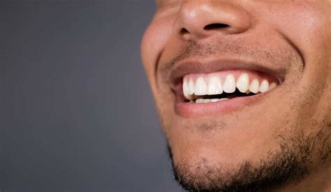 Top 5 Causes of Tooth Discoloration - Biid.org