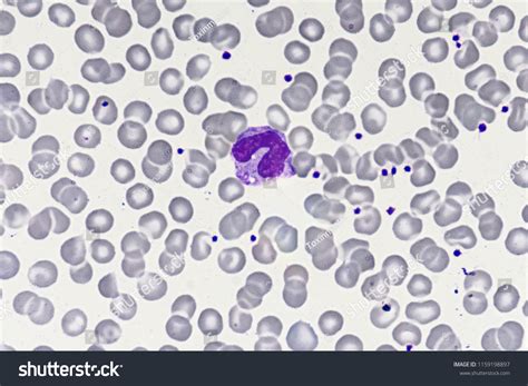 Monocyte White Blood Cell Stock Photo 1159198897 | Shutterstock