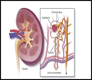 Diet Chart for Nephrotic Syndrome - Foods to Avoid and Consume in ...