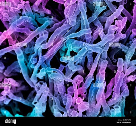 Actinomyces viscosus bacteria. Coloured scanning electron micrograph ...