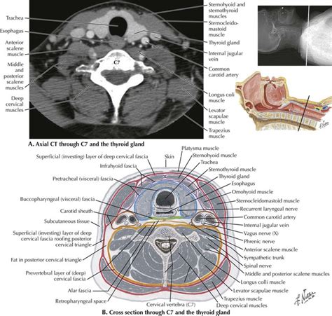 Head and Neck | Radiology Key