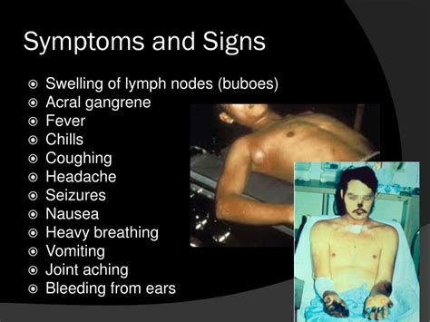 Bubonic Plague Symptoms Buboes