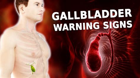 6 Signs You Might Have A Serious Problem With Your Gallbladder - YouTube