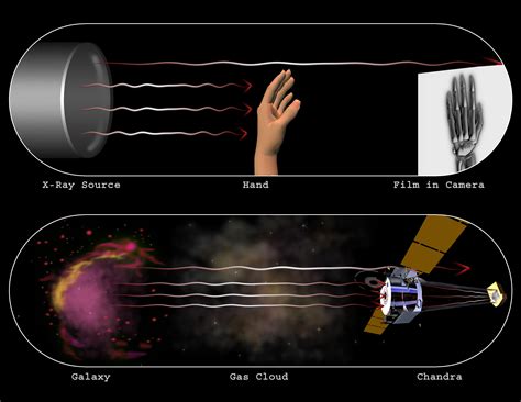 Chandra :: Resources :: X-Ray Astronomy vs. Medical X-Rays