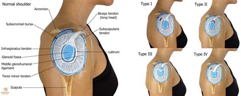 Shoulder anatomy, Bicep tendonitis, Shoulder surgery