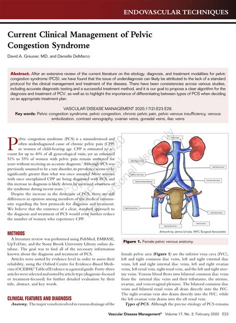 What Is Pelvic Congestion Syndrome Treatment