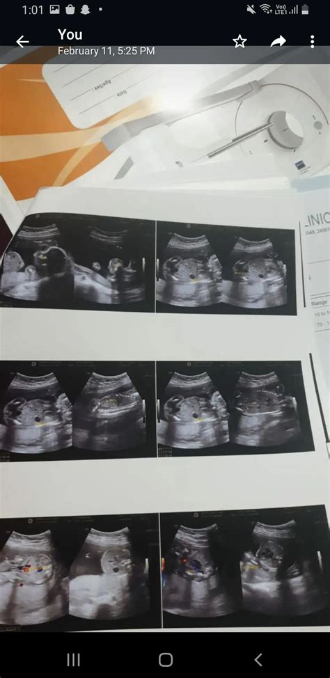 Level 2 ultrasound report