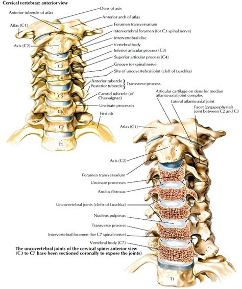 Neck sprain causes, symptoms, recovery time, treatment & exercises