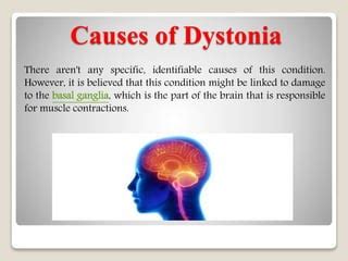 Dystonia: Causes, Types, Symptoms, and Treatments | PPT