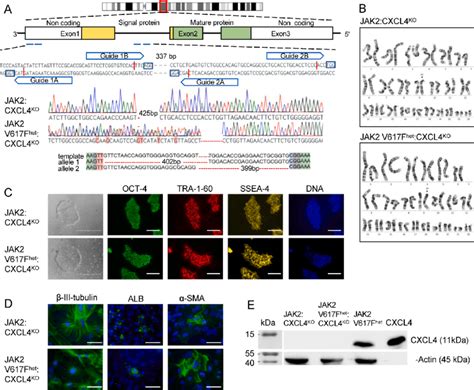 (A) Schematic representation of CXCL4 gene structure and position in ...