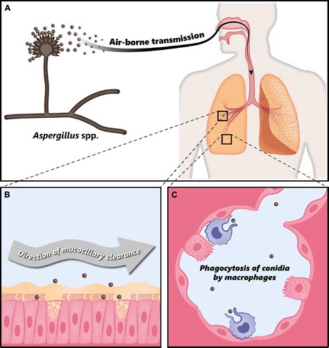 Frontiers | Recent Advances in Fungal Infections: From Lung Ecology to ...