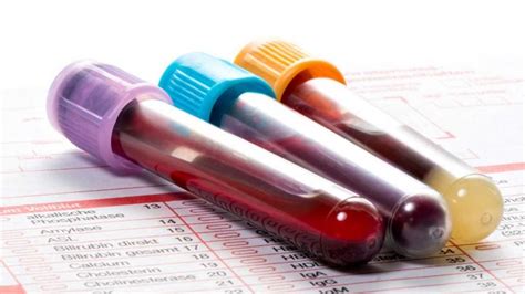 Blood Tests and Lab Tests - Diagnostics