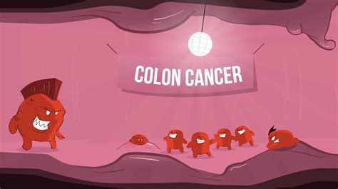 "Trust Your Gut" Colon Cancer Explainer Video - Digital Brew