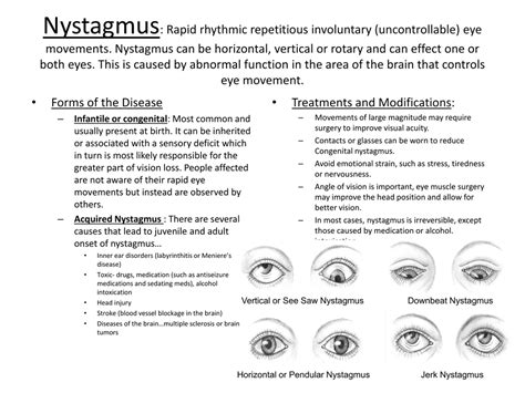 Nystagmus