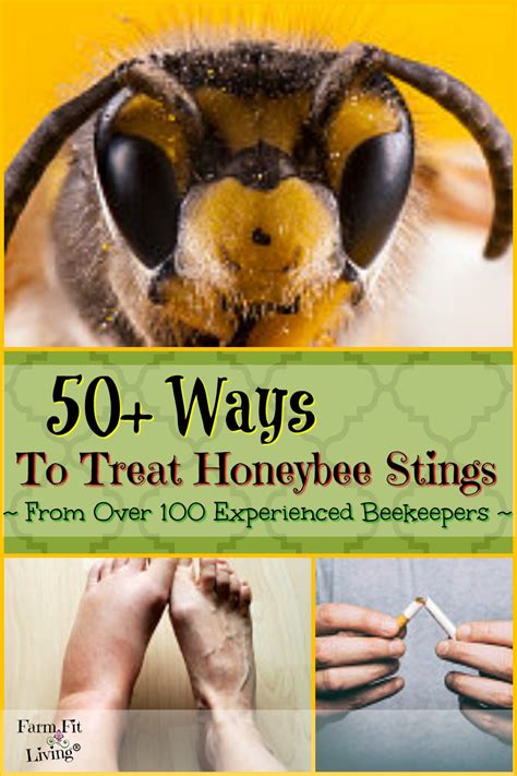 50+ Ways to Treat Honeybee Stings From Over 100 Beekeepers | Farm Fit Living