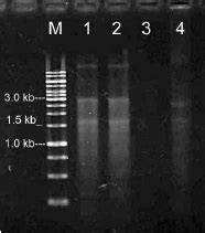 Extracted RNA by 1.0% agarose gel electrophoresis from modified... | Download Scientific Diagram