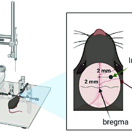 Schematic image of stereotaxic surgery for the injection brain tumor... | Download Scientific ...