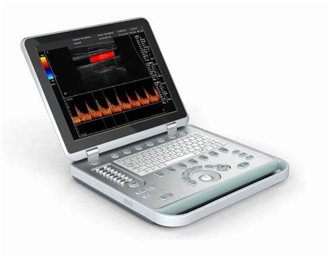 Light Portable 3D Handheld Doppler Ultrasound Machine With 15" LED Screen