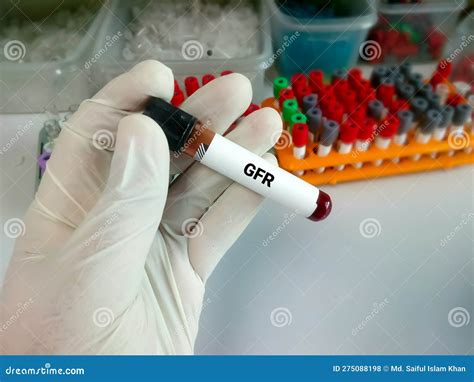 Glomerular Filtration Rate (GFR). Diagnosis of Renal Kidney Disease ...