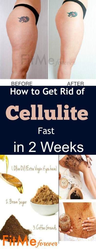 Pin on Cellulite - Exercise to Remove Cellulite and Fat