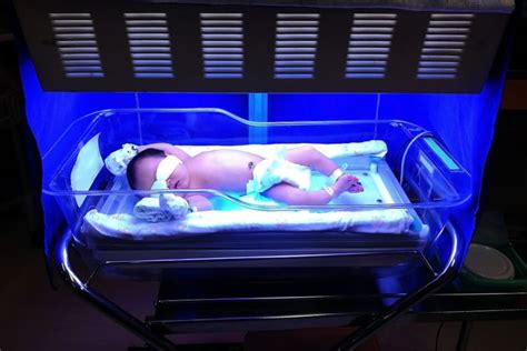 How Does Light Therapy Work For Jaundice In Newborns? Is It Safe For Your Baby? - 1happykiddo