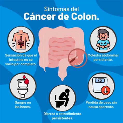 cancer de colon – Acudir Emergencias Médicas