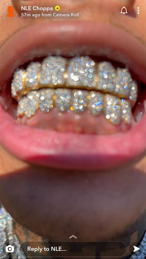 nle choppa grill | Diamond grillz, Grills teeth, Grillz teeth