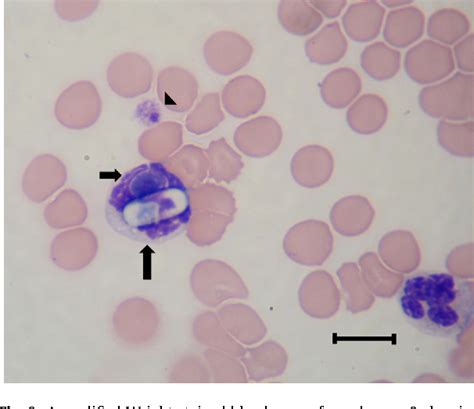 Canine vector-borne co-infections: Ehrlichia canis and Hepatozoon canis ...