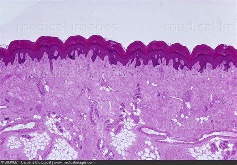 STOCK IMAGE, photomicrograph of human palmar skin showing the epidermis ...