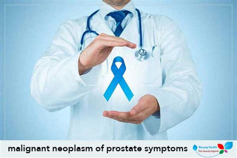 Malignant Neoplasm Of Prostate Symptoms | Health Beauty